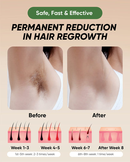 Hair Removal, At-Home IPL Hair Removal for Women and Men Hair Removal, Upgraded 999,999 Flashes, Painless and Durable,Easy Home Use Hair Removal for Body, Face, Bikini Zone