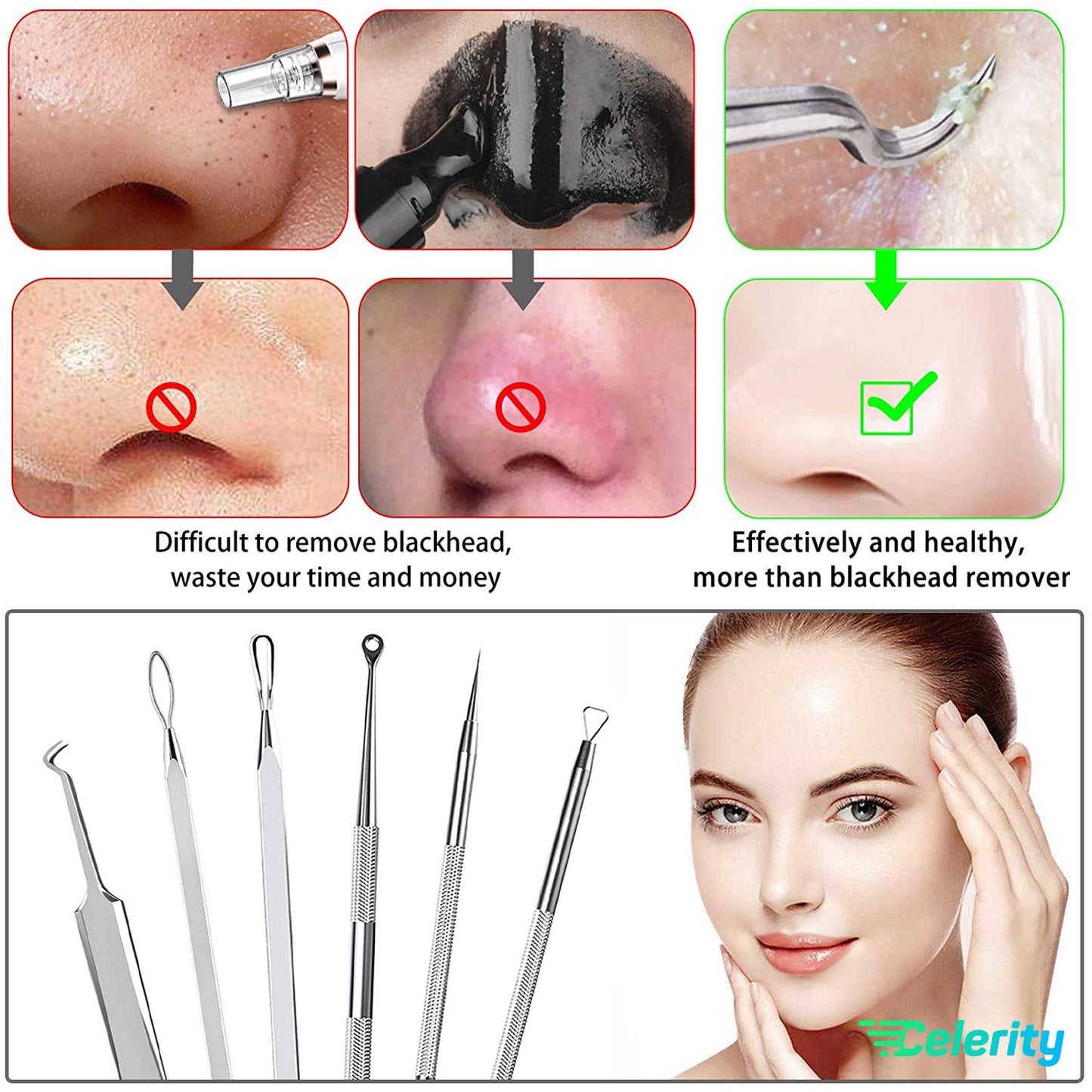 Celerity 06 Piece Professional Stainless steel Tweezer kit With Leather Case |Blackheads Pimple Acne Remover Plus Comedone Extractor tweezers Eyebrow Facial Hairs for Women and Men Beauty