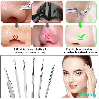 Celerity 06 Piece Professional Stainless steel Tweezer kit With Leather Case |Blackheads Pimple Acne Remover Plus Comedone Extractor tweezers Eyebrow Facial Hairs for Women and Men Beauty