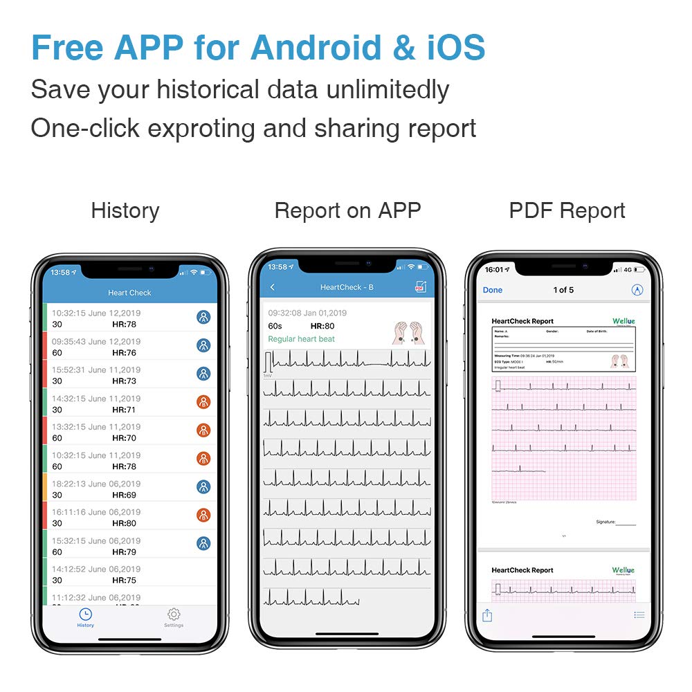 Wellue ECG Monitor, Heart Monitor with EKG, Bluetooth Heart Monitoring Device with iOS & Android App, 30s/60s/5mins Recording, Work with Smartphone and PC, Personal Portable Heart Health Tracker Home