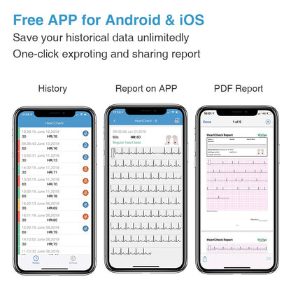 Wellue ECG Monitor, Heart Monitor with EKG, Bluetooth Heart Monitoring Device with iOS & Android App, 30s/60s/5mins Recording, Work with Smartphone and PC, Personal Portable Heart Health Tracker Home