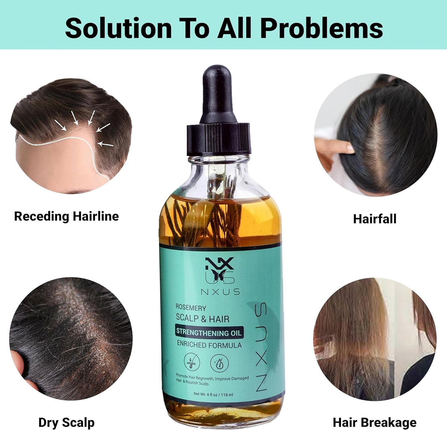 NXUS 118ml Large Rosemary Oil For Hair Growth With Scalp Massager & Derma Roller (0.25mm) To Stop Hair Fall & Receding Hair Line Scalp & Hair Strengthening Oil 100%Organic & Natural Hair Growth Serum