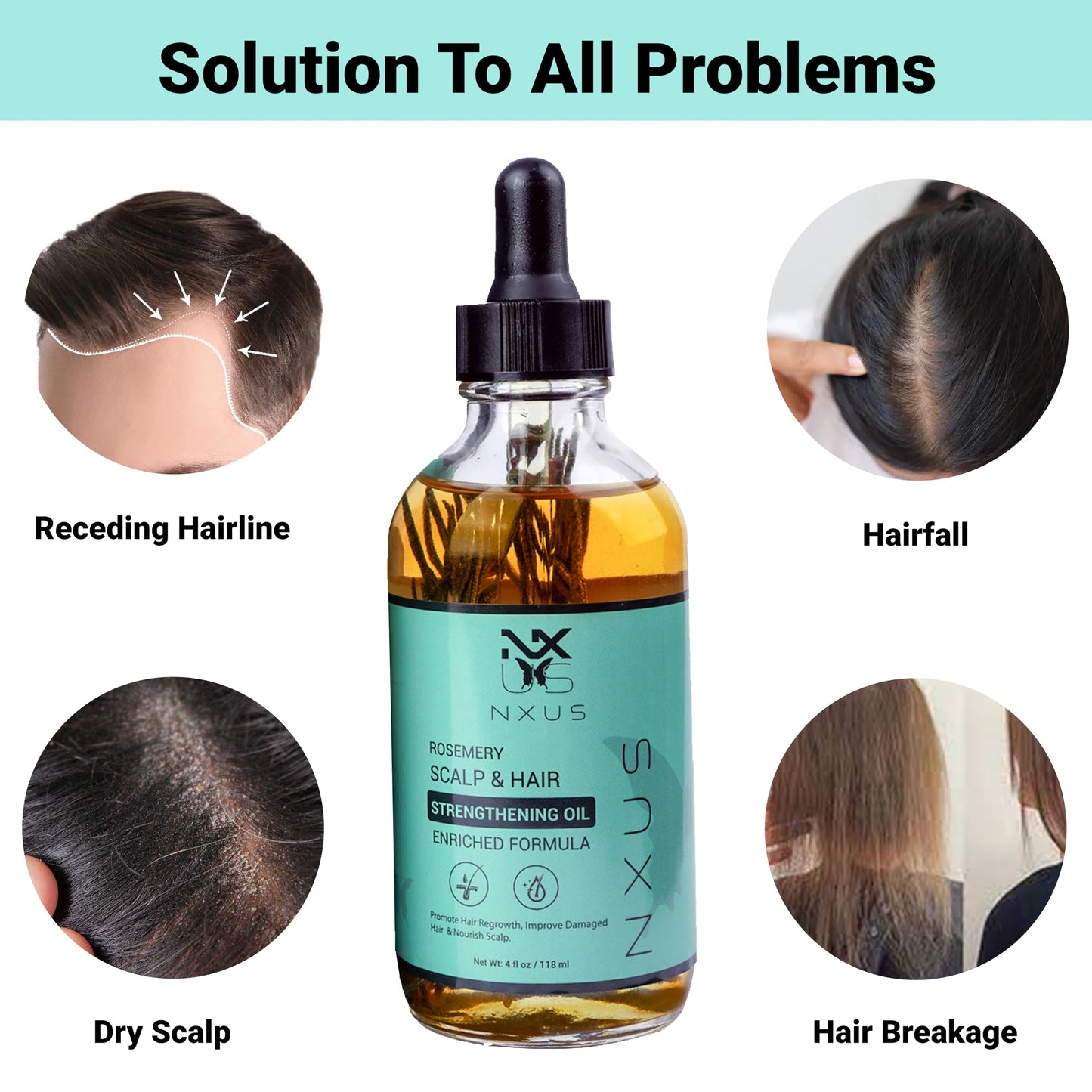 NXUS 118ml Large Rosemary Oil For Hair Growth With Scalp Massager & Derma Roller (0.25mm) To Stop Hair Fall & Receding Hair Line Scalp & Hair Strengthening Oil 100%Organic & Natural Hair Growth Serum