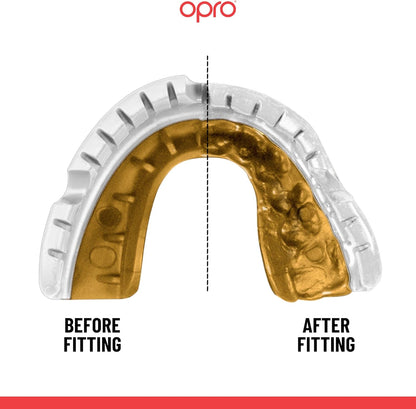 OPRO NEW Gold Braces Level Mouthguard, Adults Sports Mouth Guard, Featuring Revolutionary Fitting Technology for Boxing, Lacrosse, MMA, Martial Arts, Hockey, and All Contact Sports (Blue)