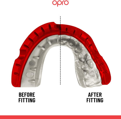 OPRO NEW Gold Braces Level Mouthguard, Adults Sports Mouth Guard, Featuring Revolutionary Fitting Technology for Boxing, Lacrosse, MMA, Martial Arts, Hockey, and All Contact Sports (Blue)