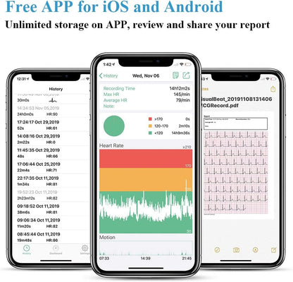 Wellue Wearable Heart Health Monitor Heart Rate and ECG/EKG Tracker With Bluetooth App